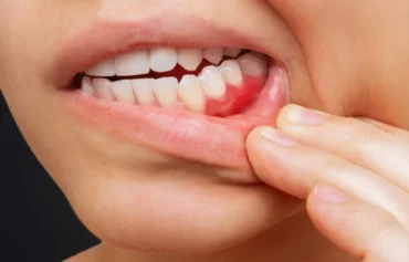 Periodontoloji